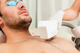 epilation laser menton homme