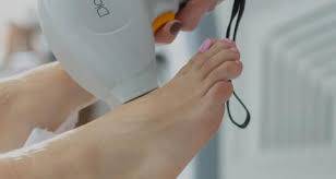 epilation laser pieds