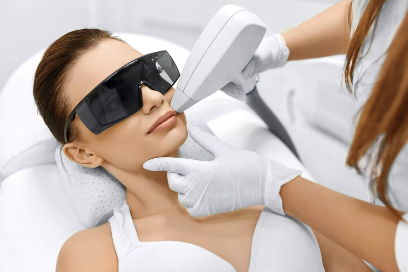 Épilation Laser du Visage pour les Femmes : Une Solution Efficace contre l’Hirsutisme avec Dépilaser